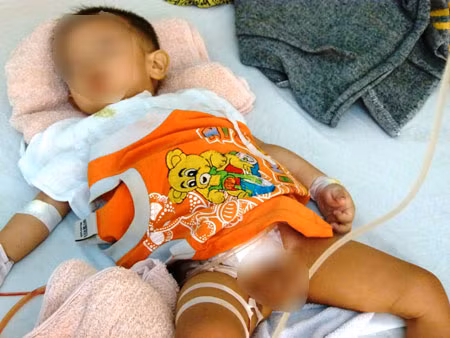 Tái tạo bàng quang cho bé bị bác sĩ cắt nhầm Tai tao bang quang cho be bi bac si cat nham