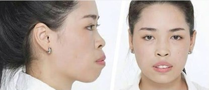 Khuôn mặt trước đây khiến Thanh Quỳnh mặc cảm, tự ti.