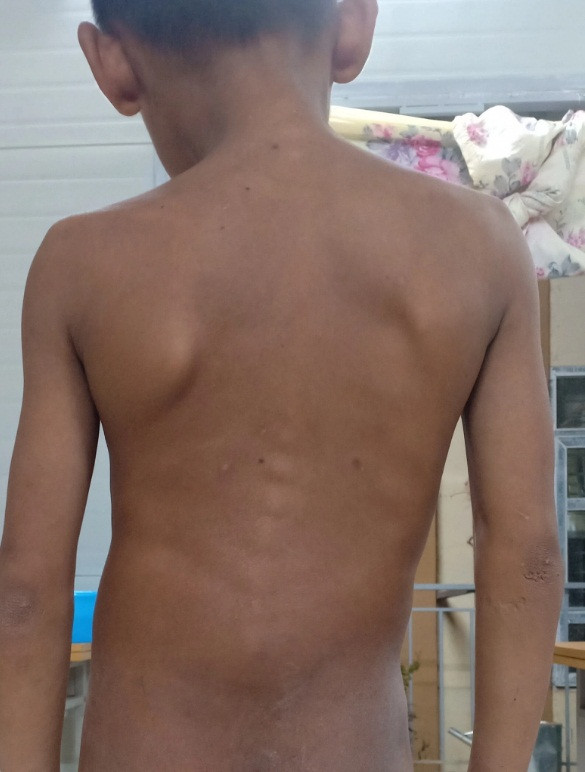 Ong Doan Ngoc Hai quyet dinh “nong” giup be bi veo xuong song-Hinh-3