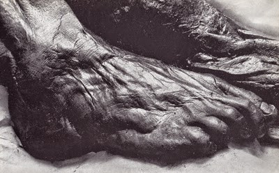 Tuy nhiên, cũng có quan điểm cho rằng Grauballe là nạn nhân một vụ án mạng. Người này bị giết một cách tàn khốc.