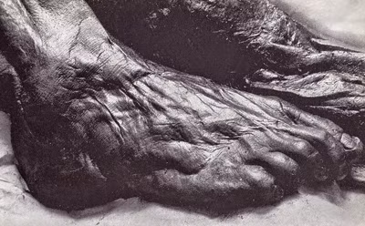 Tuy nhiên, cũng có quan điểm cho rằng Grauballe là nạn nhân một vụ án mạng. Người này bị giết một cách tàn khốc.