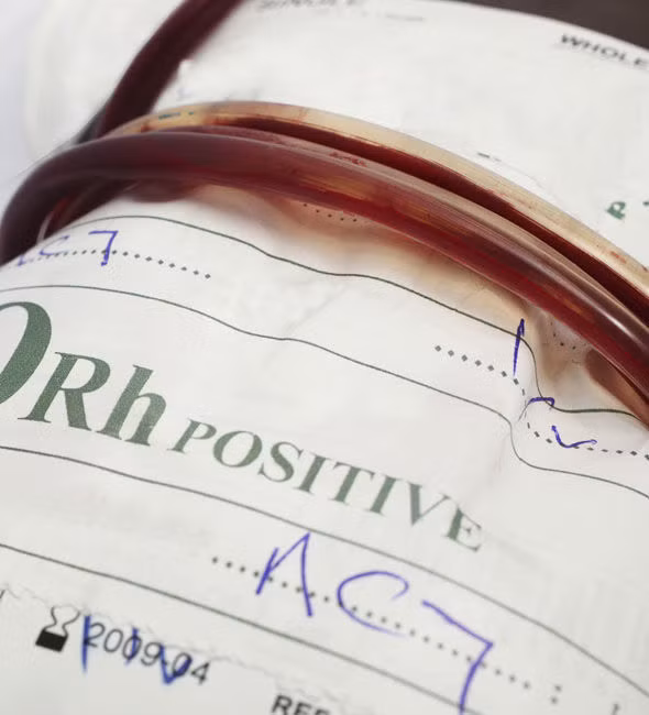 Nghiên cứu của các nhà khoa học chỉ ra khoảng 85% người trên thế giới có RH+ trong máu, có nghĩa họ thuộc các nhóm máu O+, A+, B+, AH+.