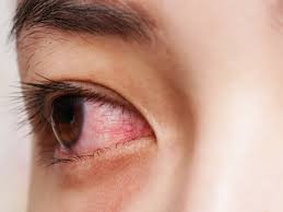 Không chỉ khóc ra máu, Inman còn chảy máu ở mũi và miệng khiến các bác sĩ "đau đầu".