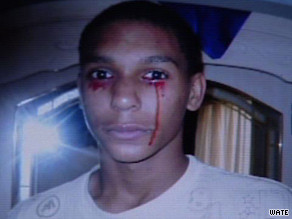 Vào năm 2015, Inman khiến nhiều người bất ngờ khi khóc ra máu sau khi có cơn đau đầu dữ dội.