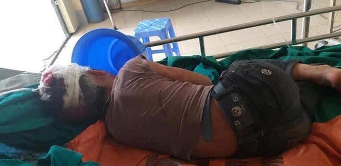 Ha Giang: Hai con thoat chet than ky khi bong dung bi bo “xuong tay”