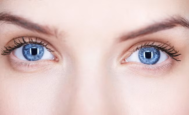 Các chuyên gia cho biết khoảng 20% người dân thế giới có thói quen ngủ mở mắt.