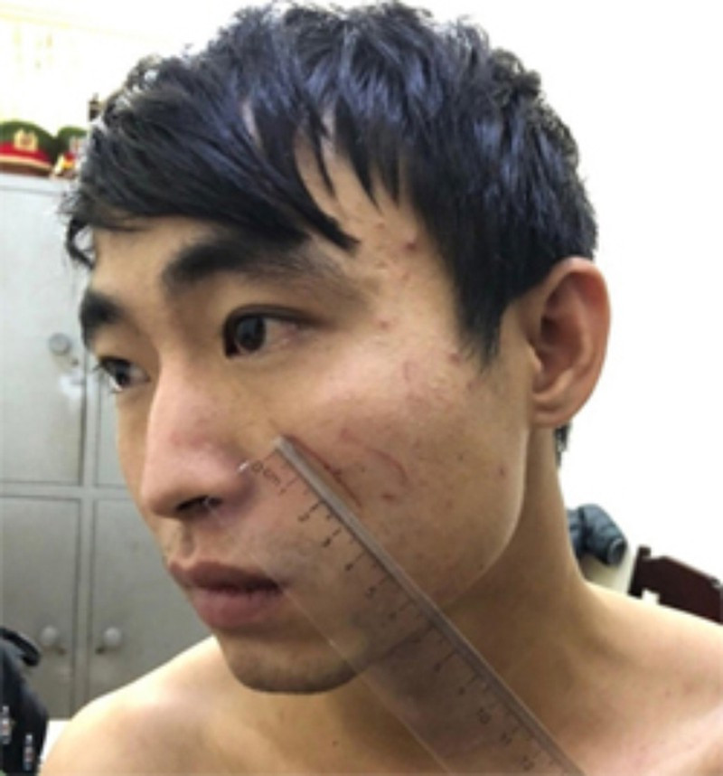 Nu sinh 19 tuoi bi nguoi yeu sat hai do ao giac-Hinh-2