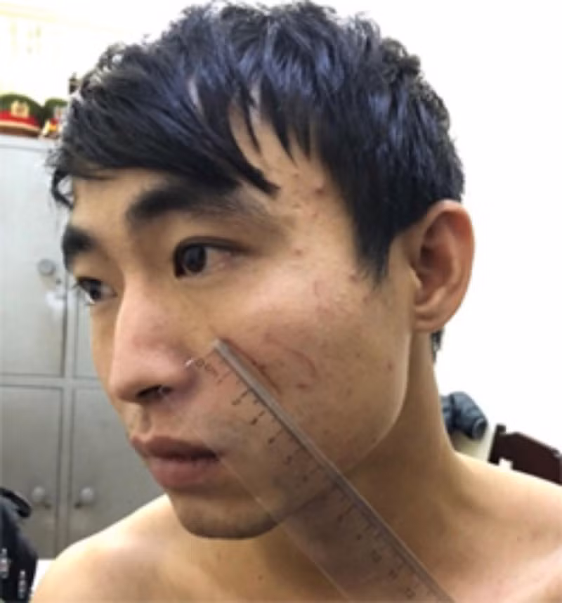 Nu sinh 19 tuoi bi nguoi yeu sat hai do ao giac-Hinh-2