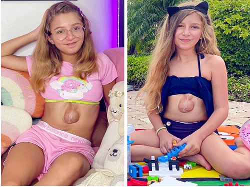 Theo chia sẻ, mặc dù mắc hội chứng Cantrell song Virsaviya rất thích các hoạt động sôi nổi và gia đình luôn ủng hộ. Cụ thể, Virsaviya thích khiêu vũ, vẽ, cưỡi ngựa và nghe Beyoncé. Mặc dù chạy bộ khá nguy hiểm song Virsaviya vẫn yêu thích hoạt động này. Để bảo vệ tim, Virsaviya luôn mặc áo ngực dày, chất liệu mềm mại.