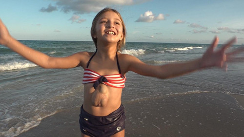 Bất chất tiên lượng ảm đạm, với tình yêu vô bờ của mình, bà Dari quyết tâm hạ sinh bé gái. Đối diện vô vàn khó khăn, hiện Virsaviya vẫn khỏe mạnh, vui sống như một phép màu. (Ảnh: Inside)