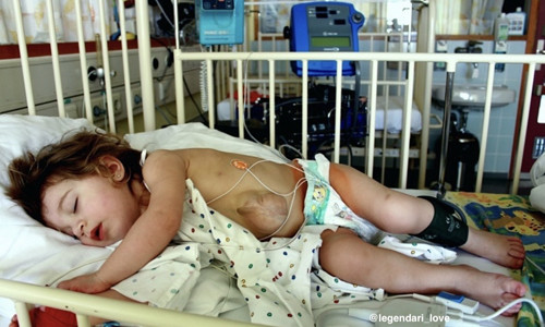 Ngay từ khi chào đời, Virsaviya đối mặt vô số thử thách do tình trạng hiếm gặp, trái tim cô bé không được bảo vệ bởi khung xương sườn và cơ bụng.