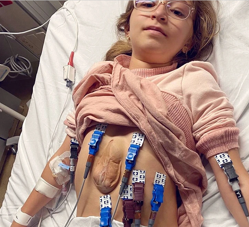 Dari cũng chia sẻ, thật không dễ dàng để Virsaviya sống với trái tim ngoài lồng ngực. Mặc dù không gây đau đớn hay cản trở sinh hoạt hàng ngày song sức khỏe của Virsaviya dễ tổn thương đến mức Dari nghĩ thôi cũng lo sợ. Đôi khi Virsaviya cảm thấy chóng mặt khi nồng độ oxy trong máu thấp song cô chưa bao giờ lấy lý do sức khỏe để trì hoãn bản thân.