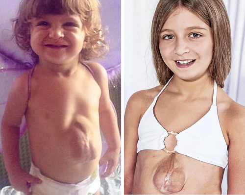 Cho đến nay, Virsaviya nhận được nhiều sự ủng hộ của người quan tâm trên Instagram. Họ coi Virsaviya là nguồn cảm hứng, động viên họ khi đối diện khó khăn cuộc sống.