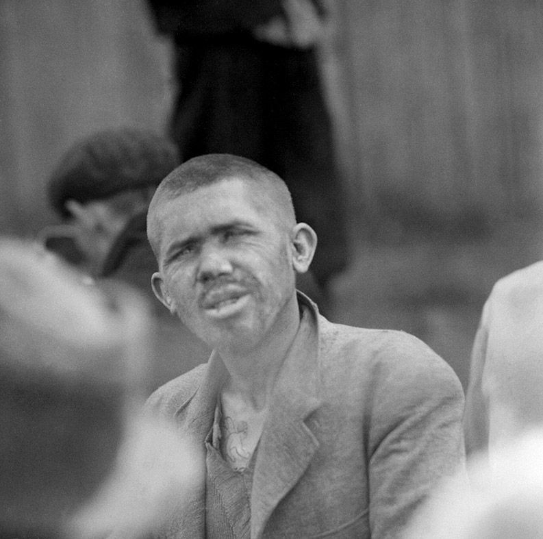 Gương mặt xơ xác, không còn sức sống của một tù nhân ở trại tập trung Bergen-Belsen.