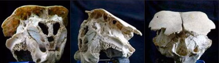 Chưa hết, hộp sọ này có tới 6 khoang chứa, tức hộp sọ này có nhiều giác quan hơn người bình thường.