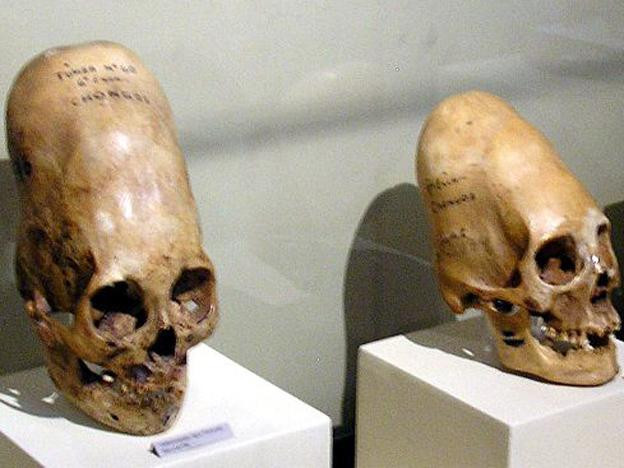 Số hộp sọ Paracas được xác định có niên đại khoảng 3.000 năm tuổi. Những hộp sọ này có hình dáng khác hẳn hộp sọ của người bình thường khi có hình dáng bị kéo dài ra phía sau. Theo các chuyên gia, những hộp sọ Paracas có thể thuộc về một cộng đồng người thời xưa thực hành tập tục làm biến dạng hộp sọ.