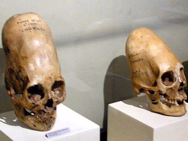 Số hộp sọ Paracas được xác định có niên đại khoảng 3.000 năm tuổi. Những hộp sọ này có hình dáng khác hẳn hộp sọ của người bình thường khi có hình dáng bị kéo dài ra phía sau. Theo các chuyên gia, những hộp sọ Paracas có thể thuộc về một cộng đồng người thời xưa thực hành tập tục làm biến dạng hộp sọ.