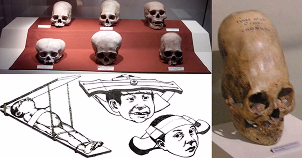 Việc tìm thấy những hộp sọ bị biến dạng giống như của người ngoài hành tinh ở Croatia khiến các chuyên gia có thể bằng chứng chứng minh sự tồn tại của tập tục làm biến dạng hộp sọ của người xưa.