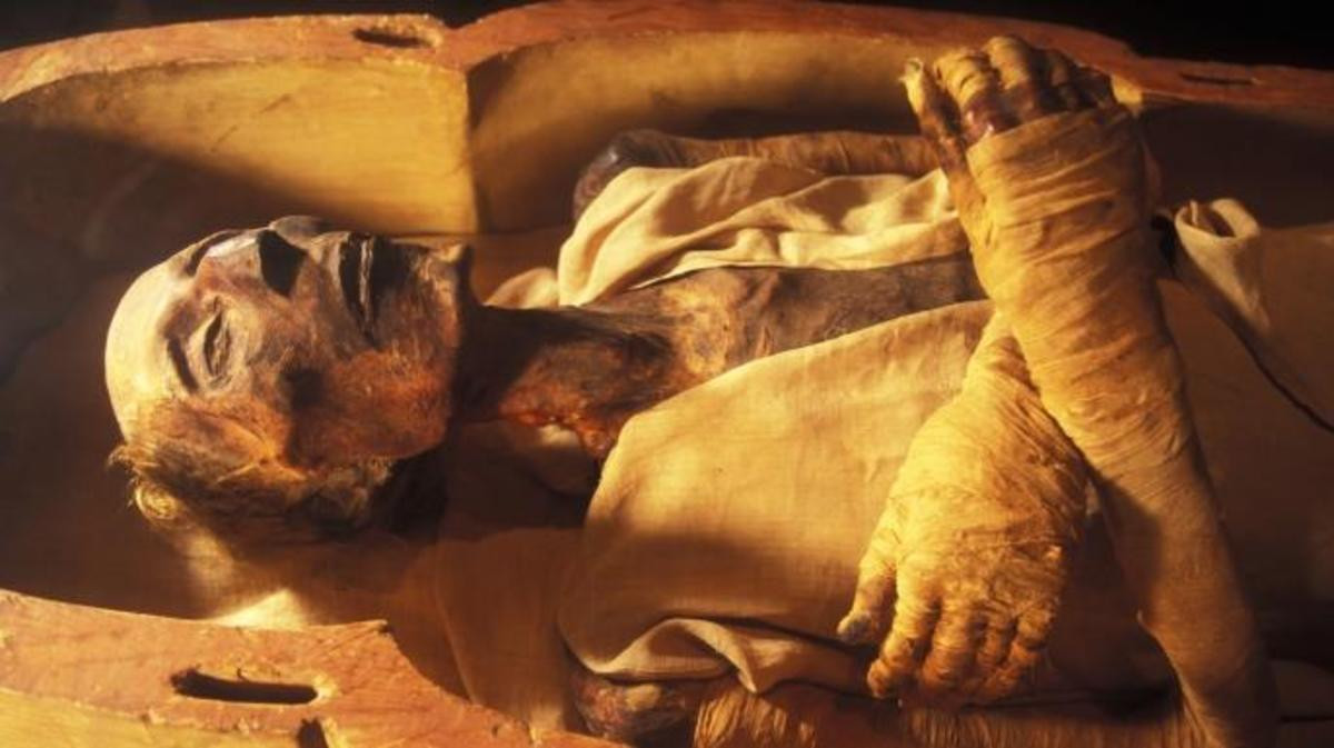 Theo các chuyên gia, dường như Ramesses II bị viêm cột sống dính khớp khiến ông hoàng này phải còng lưng khi đi lại trong những năm cuối đời.