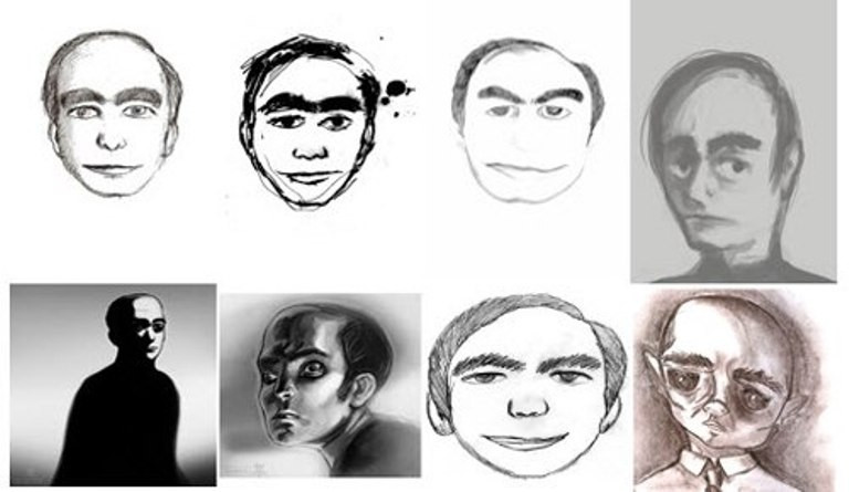 Trước sự việc kỳ lạ này, người bác sĩ gửi thông tin về 2 trường hợp trên cho các đồng nghiệp và tới nhiều bệnh viện trong và ngoài nước để xem còn có ai cũng gặp chuyện tương tự không.