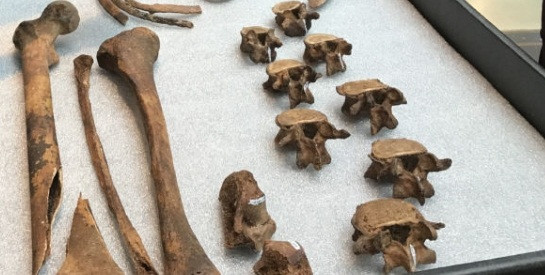 Sau khi xác định được danh tính của bộ hài cốt cùng với những căn bệnh mà người này mắc phải, các chuyên gia đưa bộ xương này đến một bảo tàng tại Silver Spring, Maryland để nghiên cứu sâu hơn.