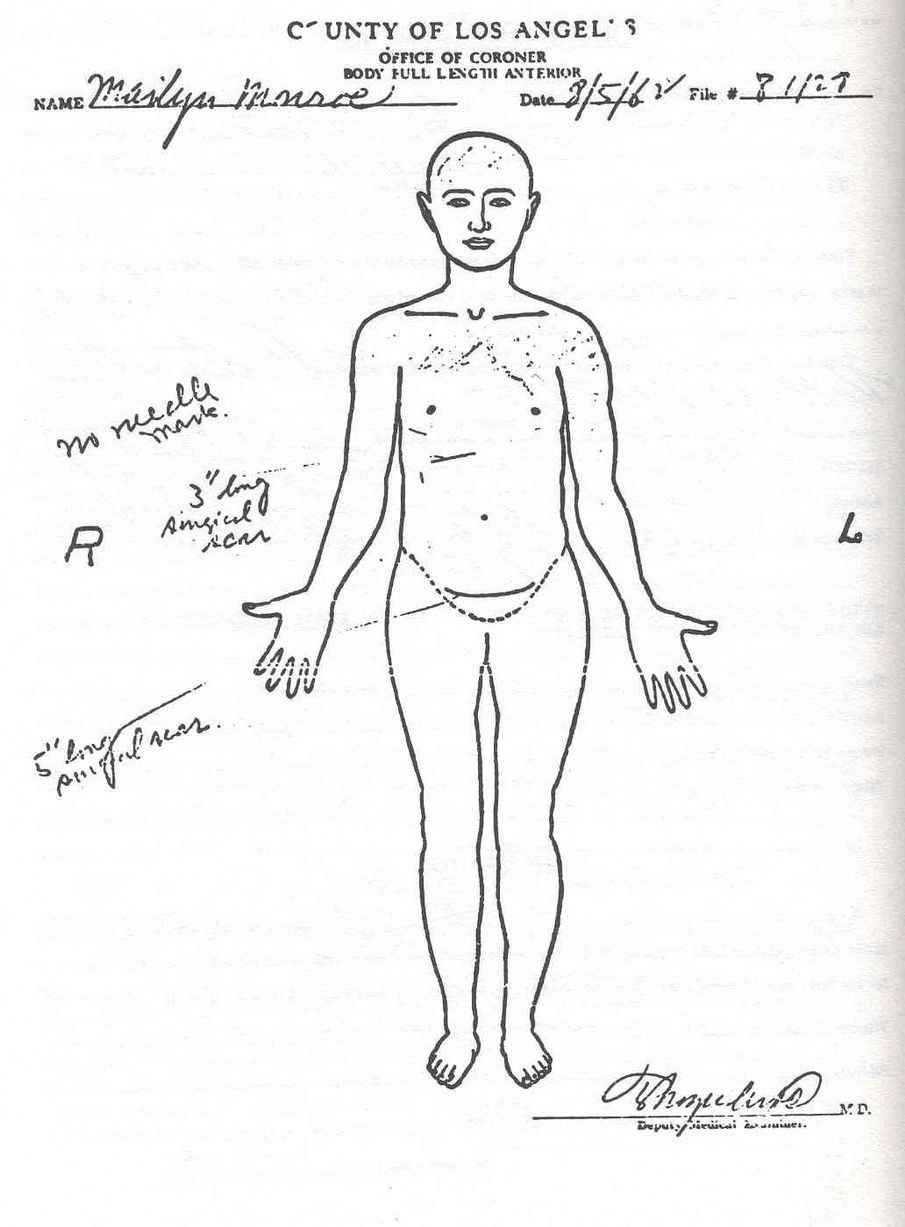 Bác sĩ pháp y lập sơ đồ y tế về tình trạng thi thể của Marilyn Monroe thông qua những kết quả thu được từ quá trình khám nghiệm tử thi. Video: Đấu giá kho ảnh 3.700 bức về Marilyn Monroe (nguồn: VTC14)