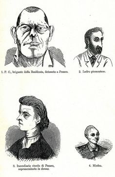 “Đôi tai thường có kích thước lớn hơn, mũi thường hếch”, bác sĩ Lombroso mô tả.