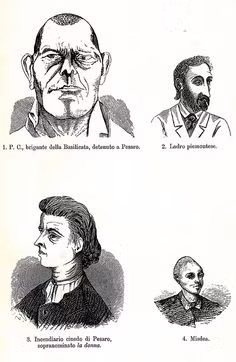 “Đôi tai thường có kích thước lớn hơn, mũi thường hếch”, bác sĩ Lombroso mô tả.