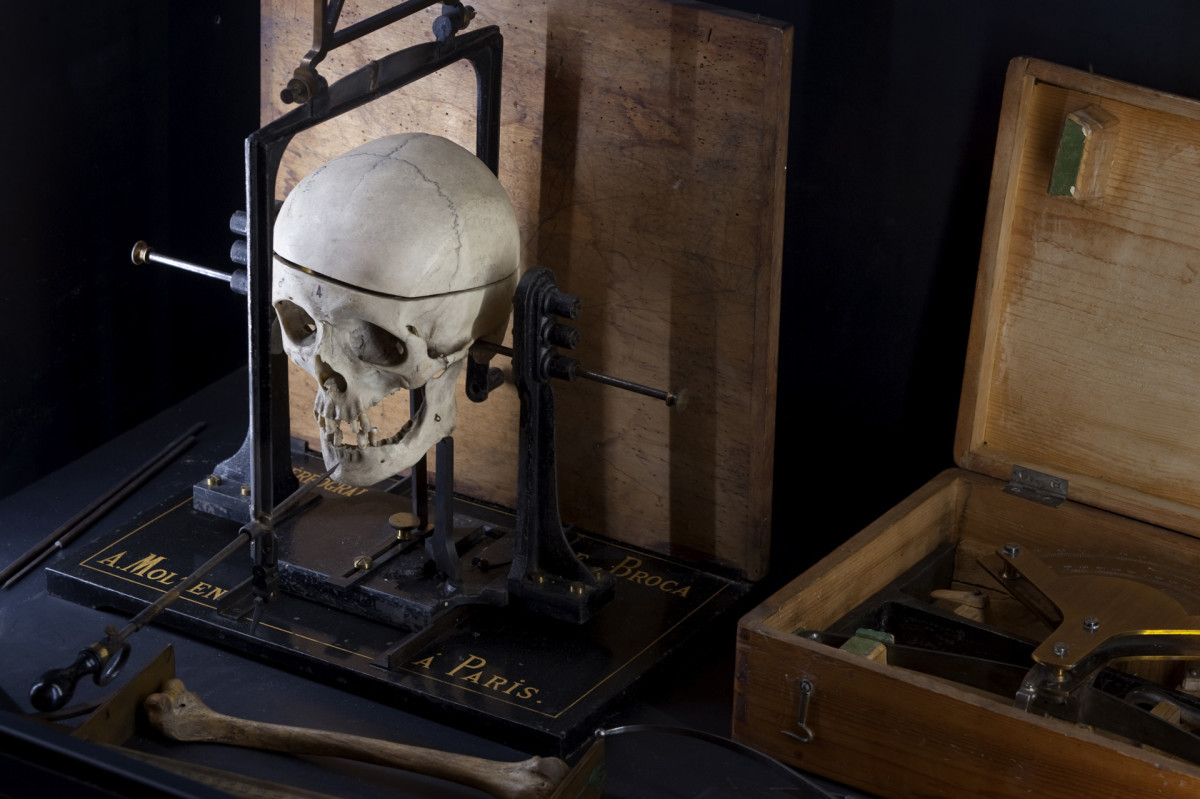 Ông Lombroso cho rằng, tội phạm là những kẻ đang đi ngược lại sự tiến hóa, có xu hướng quay trở về thời nguyên thủy.