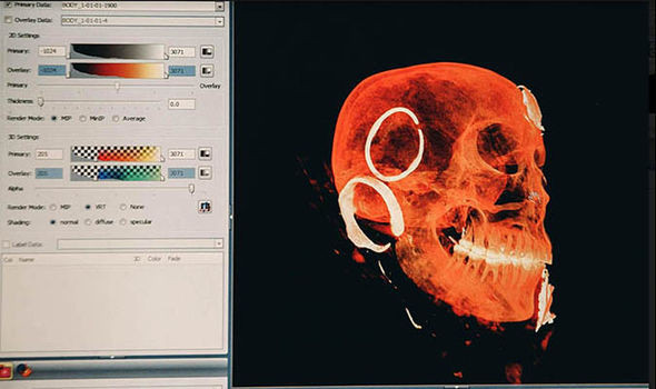 Trong khi đầu của người phụ nữ còn nguyên vẹn thì phần cơ thể còn lại không được bảo quản tốt.