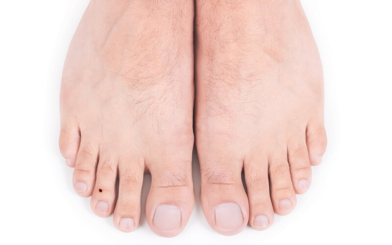 Phần lớn những người sở hữu nốt ruồi này con đường công danh lợi lộc của chủ nhân. Đặc biệt, nếu như người phụ nữ nếu sở hữu nốt ruồi ở ngón chân giữa thường có số làm ăn xa nhà nhưng sau tuổi 30 họ dễ dàng thành đạt tự mình kiếm ra nhiều tiền bạc. 