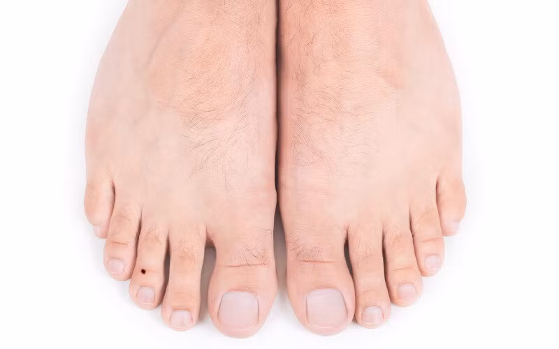 Phần lớn những người sở hữu nốt ruồi này con đường công danh lợi lộc của chủ nhân. Đặc biệt, nếu như người phụ nữ nếu sở hữu nốt ruồi ở ngón chân giữa thường có số làm ăn xa nhà nhưng sau tuổi 30 họ dễ dàng thành đạt tự mình kiếm ra nhiều tiền bạc. 