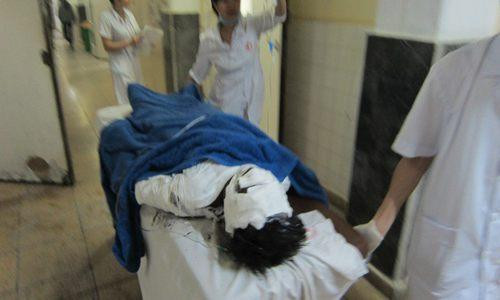 6 nguoi bi bong nang nhap vien bat thuong o Quang Ninh-Hinh-3