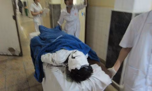 6 nguoi bi bong nang nhap vien bat thuong o Quang Ninh-Hinh-3