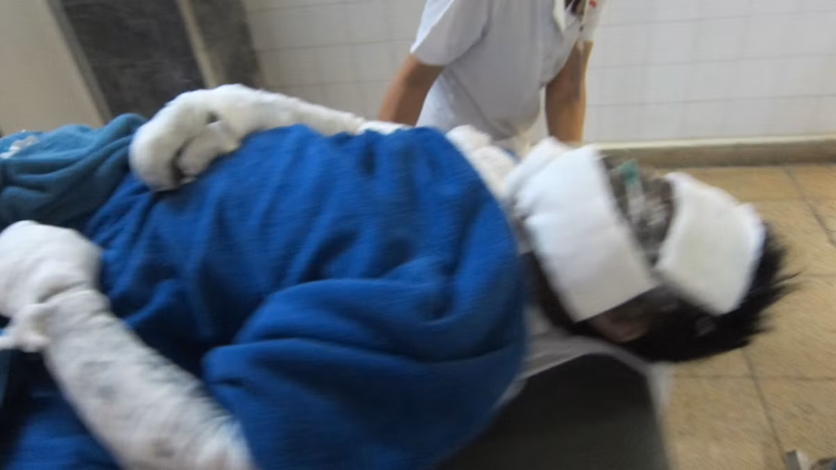 6 nguoi bi bong nang nhap vien bat thuong o Quang Ninh-Hinh-5