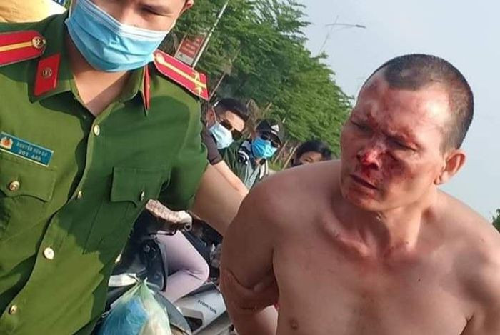 Vi sao chi ky luat cong an nhin nguoi dan bat cuop?-Hinh-2