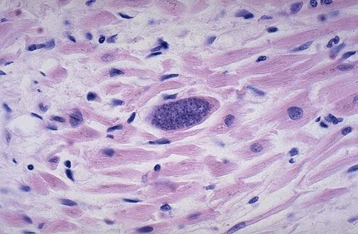 Nguy hiểm hơn cả mèo có thể làm bạn nhiễm vi khuẩn Toxoplasma. Nếu bạn đang mang thai bị nhiễm loại vi khuẩn này có thể sẽ gây ra dị tật bẩm sinh cho thai nhi trong bụng.