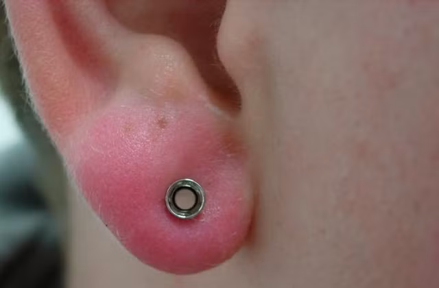 Kinh hai nhung vanh tai bien dang vi thu choi nong tai-Hinh-4