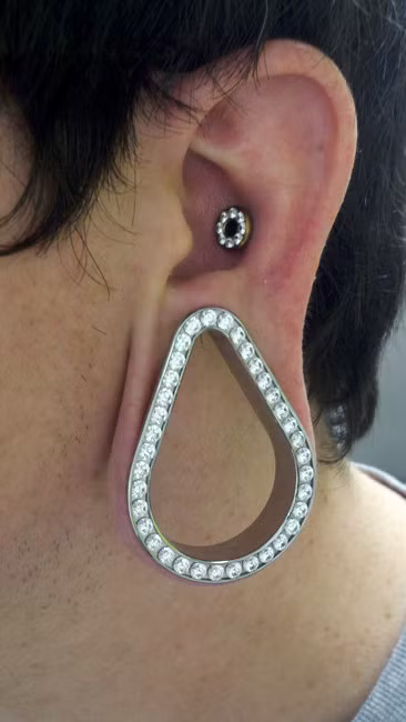 Kinh hai nhung vanh tai bien dang vi thu choi nong tai-Hinh-2