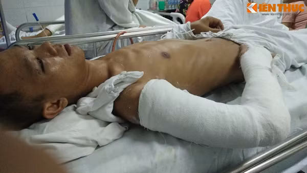 Dang ngoi uong nuoc, bi hang chuc con do truy sat