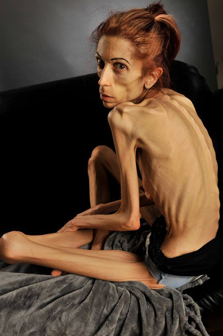 Hiện nay, vợ chồng cô Rachael đang kêu gọi từ thiện trên trang Go Fund Me để có đủ tiền chữa bệnh. 