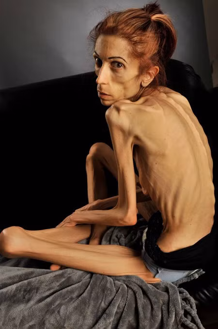 Hiện nay, vợ chồng cô Rachael đang kêu gọi từ thiện trên trang Go Fund Me để có đủ tiền chữa bệnh. 