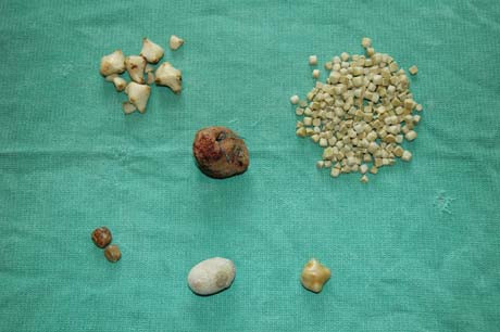 Kham pha gay soc ve nuoc bot it ai biet