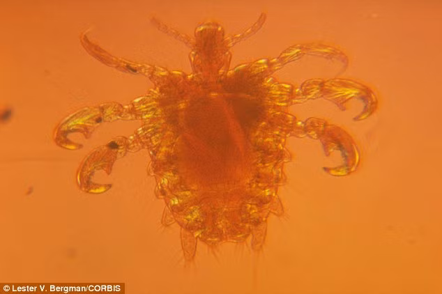 Sung so 20 con ran mu ky sinh tren long mi be gai 4 tuoi