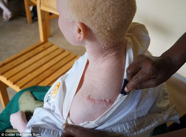 Co gai bach tang bi chat tay de lam thuoc phu thuy-Hinh-2