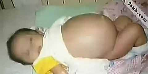 Nhiều bí ẩn chưa biết về hiện tượng trẻ sơ sinh mang thai Nhieu bi an chua biét vè hien tuong tre so sinh mang thai