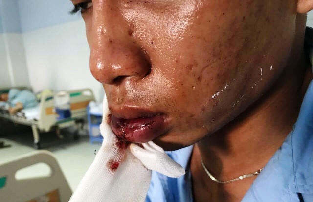 Bat duoc bang nhom cam dao kiem dap pha quan doi bao ke-Hinh-2