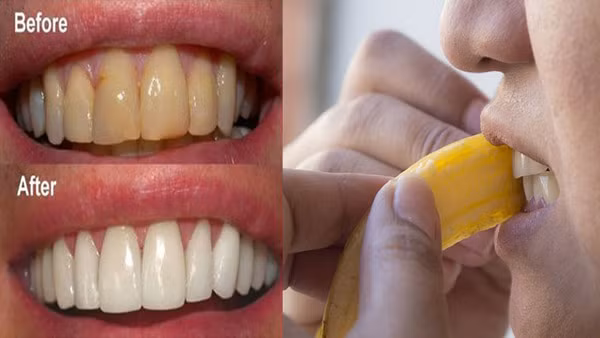 Cha rang moi ngay 10 giay voi 3 nguyen lieu nay, rang trang “khong ti vet“-Hinh-5