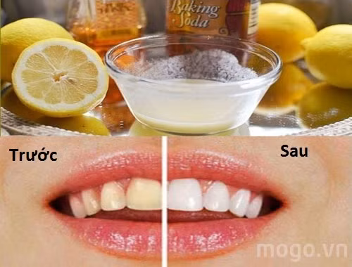 Cha rang moi ngay 10 giay voi 3 nguyen lieu nay, rang trang “khong ti vet“-Hinh-2