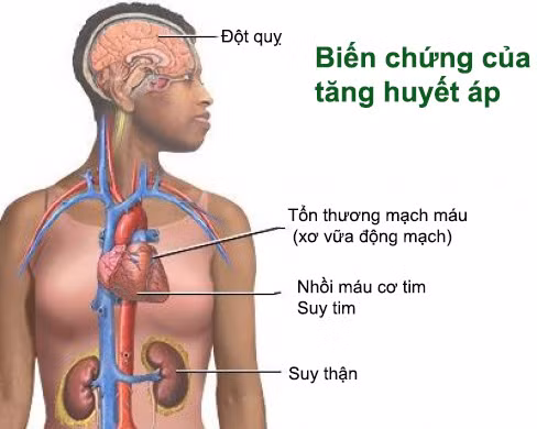 4. Chữa xơ cứng mạch máu ở người cao tuổi tăng huyết áp: Hà thủ ô (20g), tầm gửi cây dâu (16g), kỷ tử (16g), ngưu tất (16g), sắc uống ngày một thang. Ảnh: namlimxanh.vn.